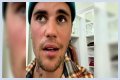 Justin Bieber Is Diagnosed With Ramsay Hunt Syndrome