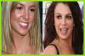 Whatâs Up with Britney Spearsâ Smile? The Scoop on Her Noticeable Gap Teeth
